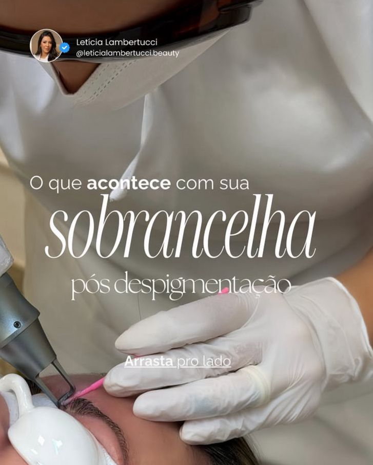 Sobrancelha pós despigmentação